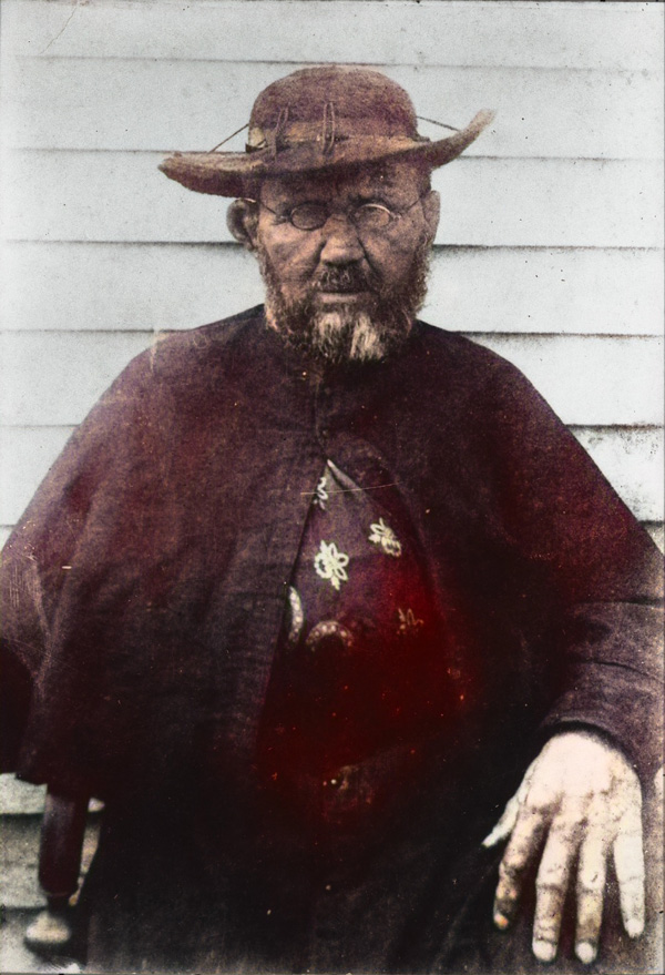 Photo of  St. Damien de Veuster shortly before his death at age 49.